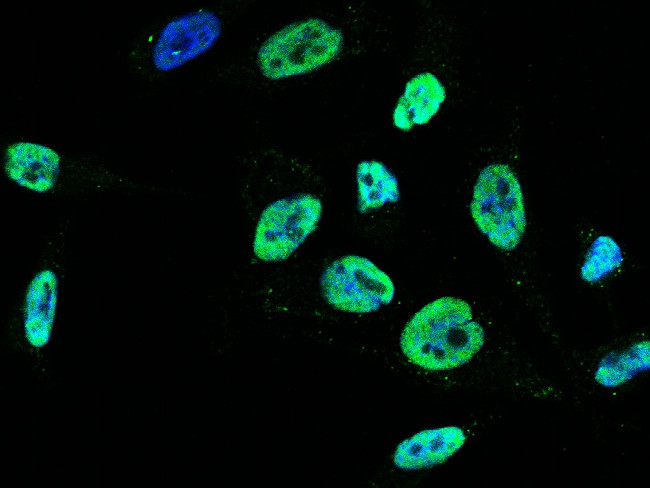 PSME3 Antibody in Immunocytochemistry (ICC/IF)