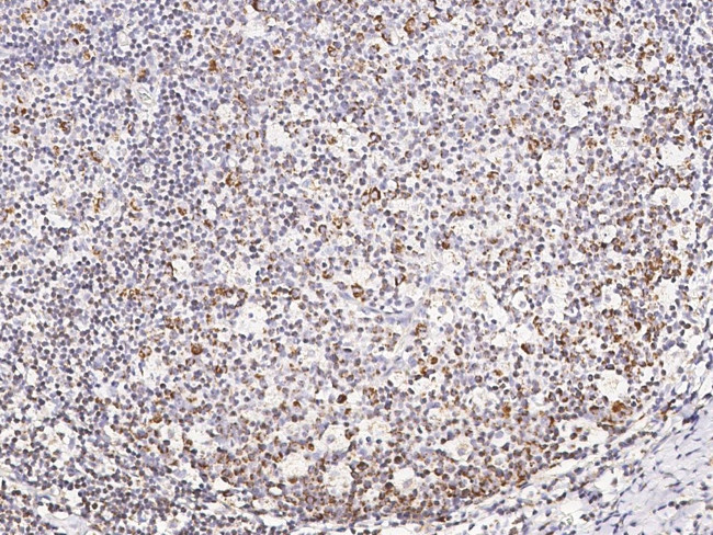 CD45 Antibody in Immunohistochemistry (Paraffin) (IHC (P))