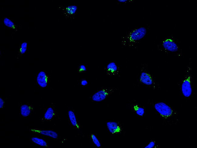 RAB6A Antibody in Immunocytochemistry (ICC/IF)