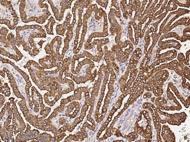 RhoBTB2 Antibody in Immunohistochemistry (Paraffin) (IHC (P))