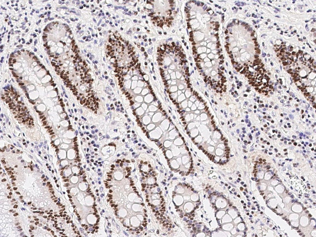 RNaseH2B Antibody in Immunohistochemistry (Paraffin) (IHC (P))