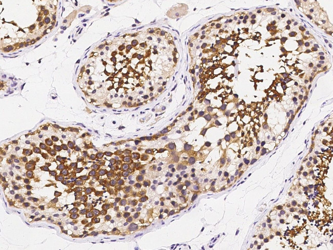 RUVBL1 Antibody in Immunohistochemistry (Paraffin) (IHC (P))