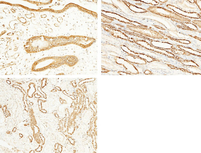 S100A6 Antibody in Immunohistochemistry (Paraffin) (IHC (P))