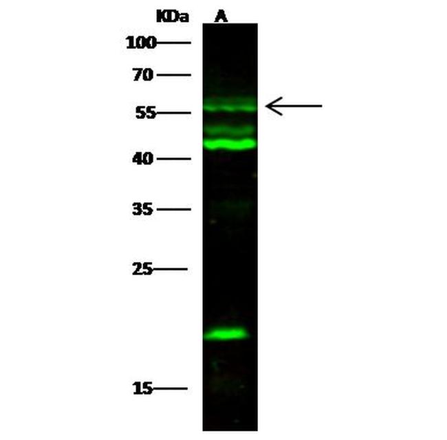 SCLY Antibody in Western Blot (WB)