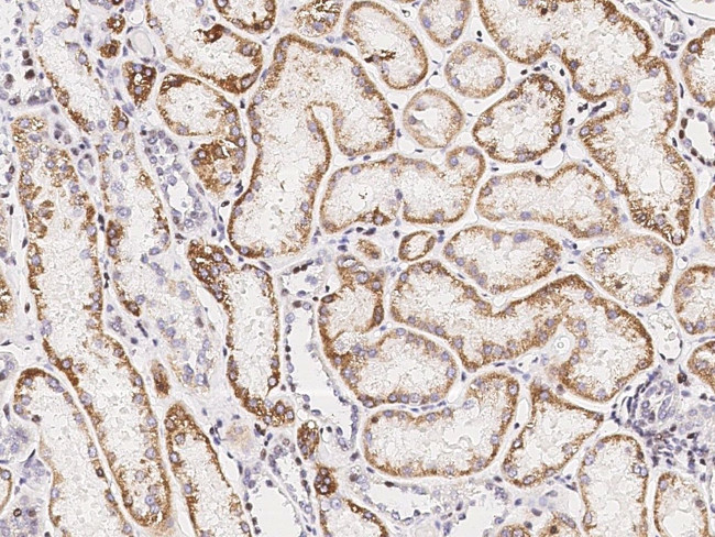 SDHB Antibody in Immunohistochemistry (Paraffin) (IHC (P))