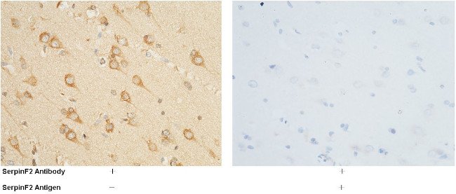 SERPINF2 Antibody in Immunohistochemistry (Paraffin) (IHC (P))