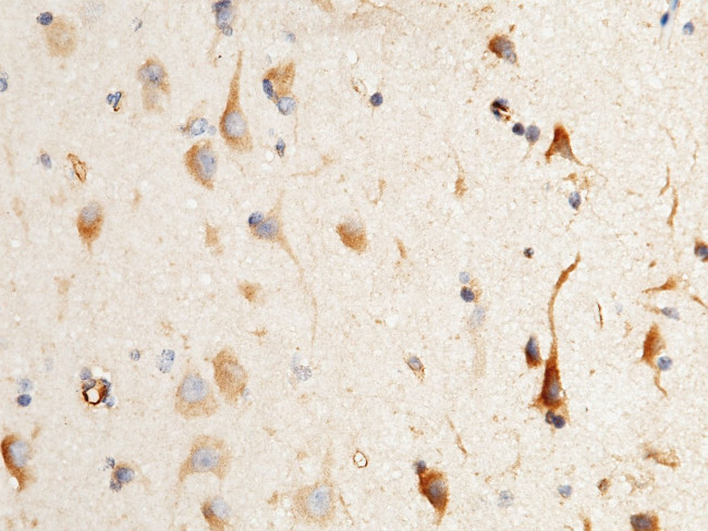 Neuroserpin Antibody in Immunohistochemistry (Paraffin) (IHC (P))