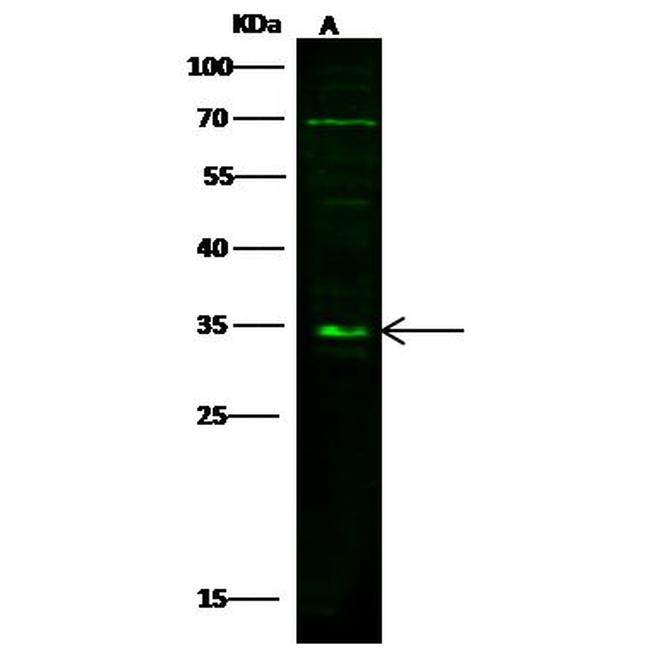 SIRT5 Antibody in Western Blot (WB)
