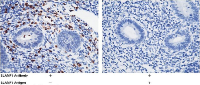 CD150 Antibody in Immunohistochemistry (Paraffin) (IHC (P))
