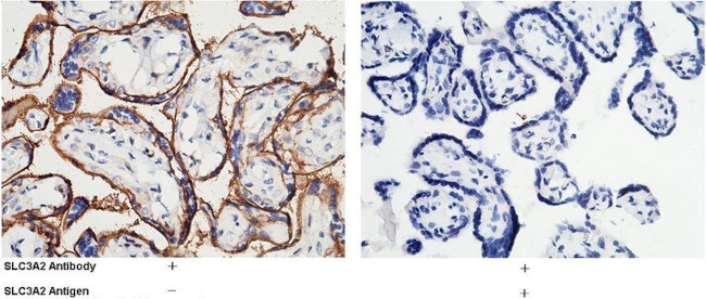 CD98 Antibody in Immunohistochemistry (Paraffin) (IHC (P))