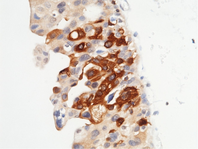 MST1 (STK4) Antibody in Immunohistochemistry (Paraffin) (IHC (P))