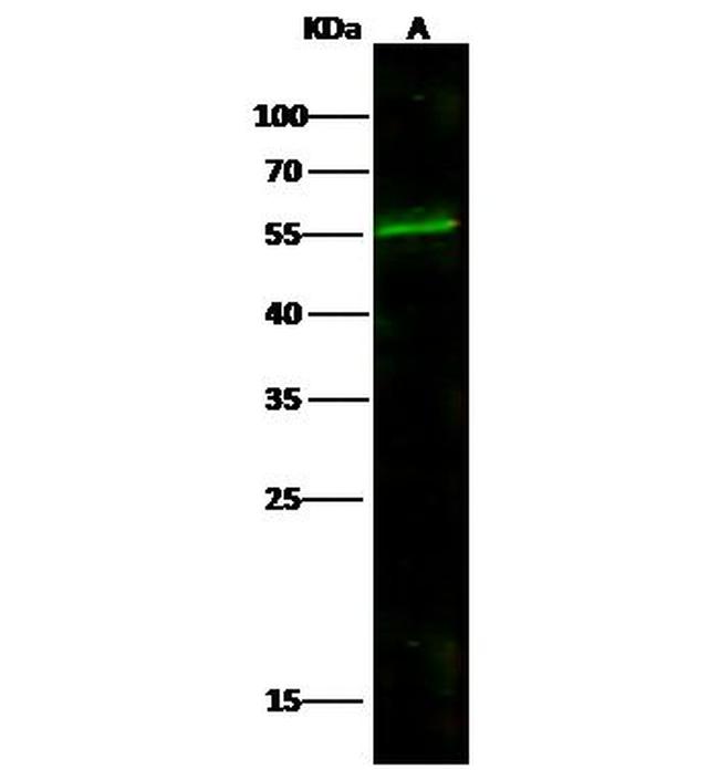 SULT2B1 Antibody in Western Blot (WB)