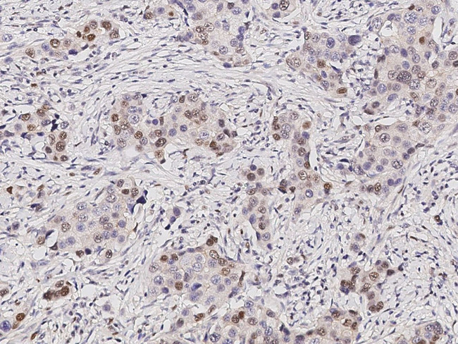 SUV39H2 Antibody in Immunohistochemistry (Paraffin) (IHC (P))