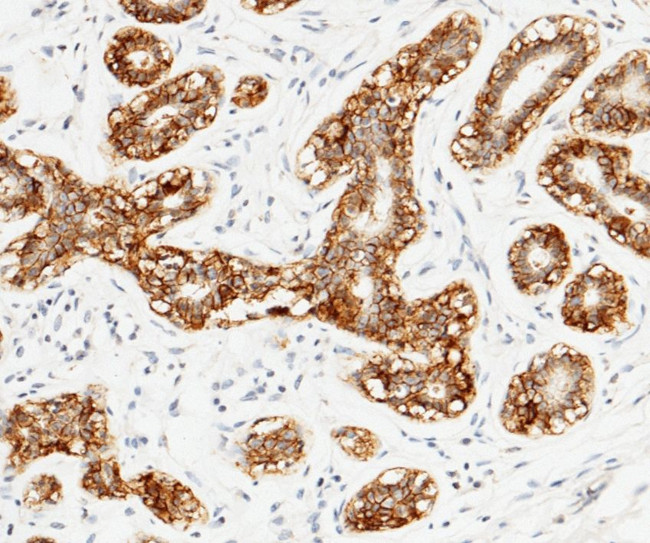 TROP2 Antibody in Immunohistochemistry (Paraffin) (IHC (P))