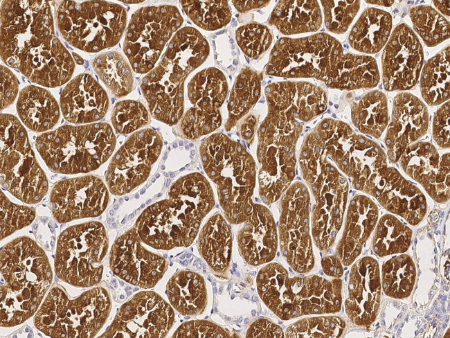 DP2 Antibody in Immunohistochemistry (Paraffin) (IHC (P))