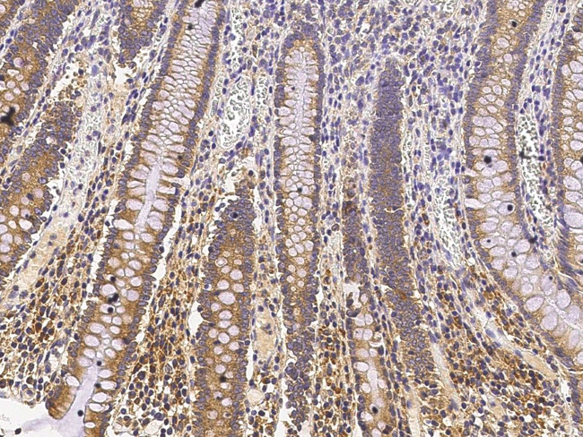 TGFBR1 Antibody in Immunohistochemistry (Paraffin) (IHC (P))