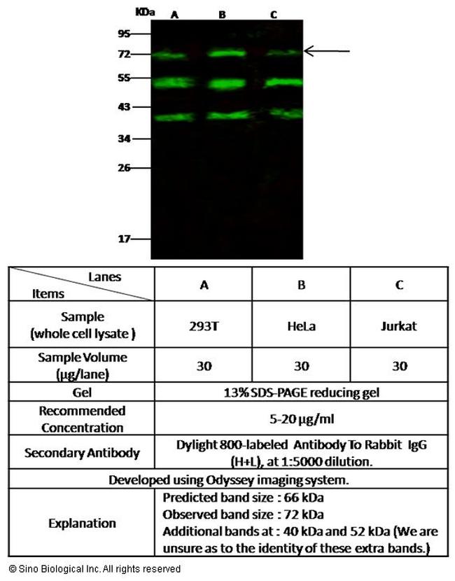 RANK Antibody in Western Blot (WB)