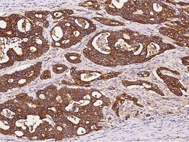 APRIL Antibody in Immunohistochemistry (Paraffin) (IHC (P))