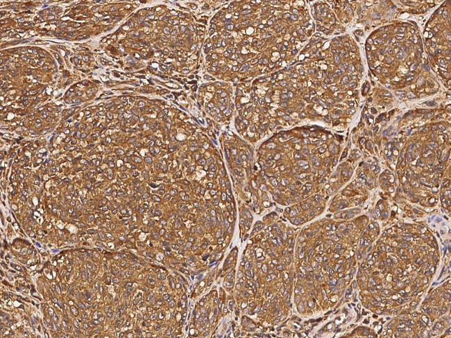 TPT1 Antibody in Immunohistochemistry (Paraffin) (IHC (P))