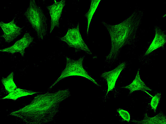 TRAF6 Antibody in Immunocytochemistry (ICC/IF)