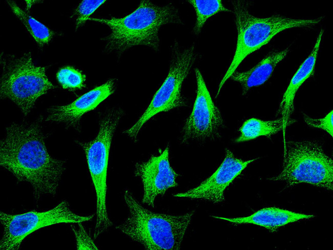 beta Tubulin Antibody in Immunocytochemistry (ICC/IF)