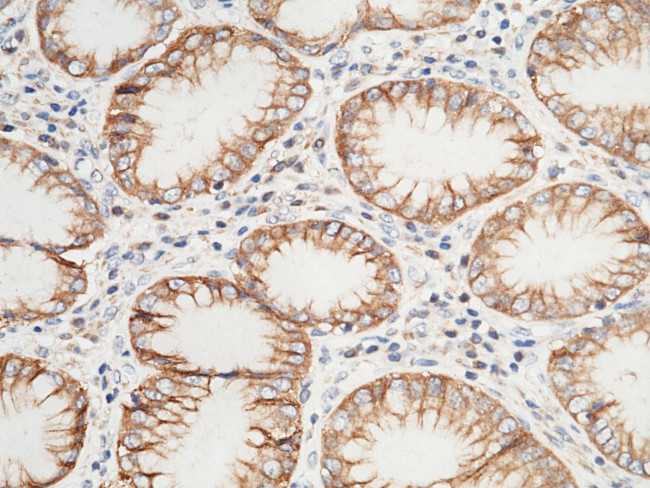 VSIG2 Antibody in Immunohistochemistry (Paraffin) (IHC (P))