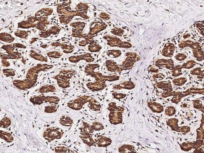 B7-H4 Antibody in Immunohistochemistry (Paraffin) (IHC (P))