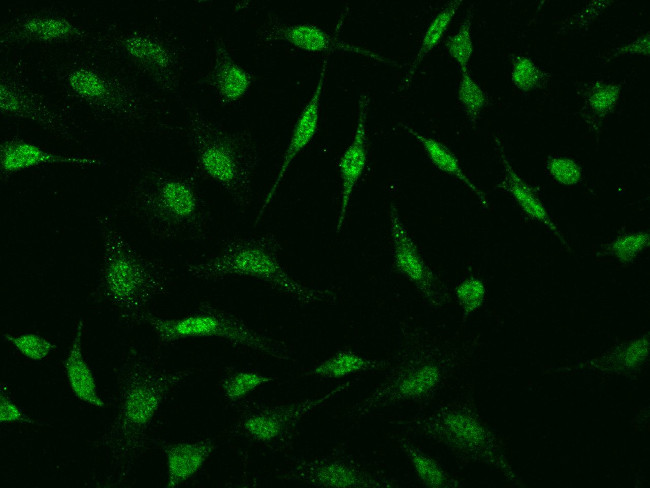 HSPB8 Antibody in Immunocytochemistry (ICC/IF)