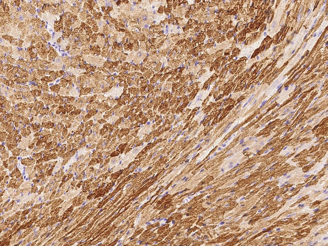 ERK3 Antibody in Immunohistochemistry (Paraffin) (IHC (P))