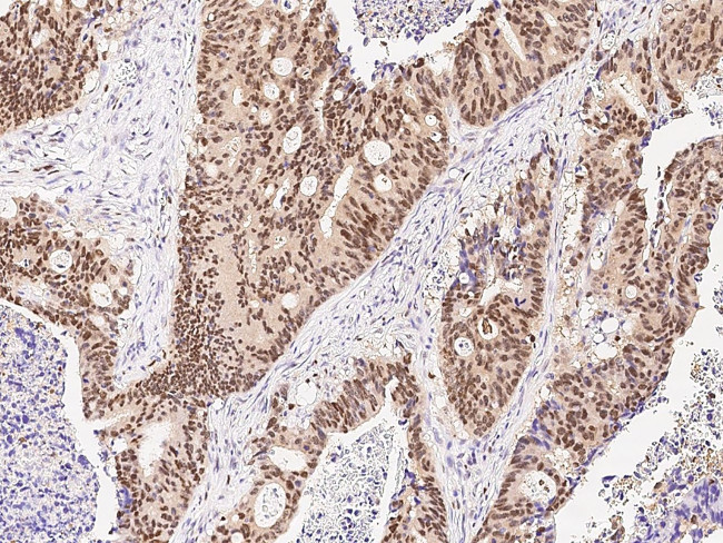 ARL4A Antibody in Immunohistochemistry (Paraffin) (IHC (P))