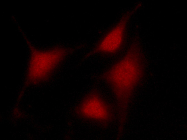 PRMT4 Antibody in Immunocytochemistry (ICC/IF)