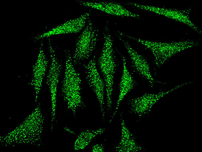 Cofilin 2 Antibody in Immunocytochemistry (ICC/IF)