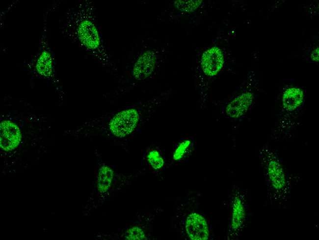 CHD4 Antibody in Immunocytochemistry (ICC/IF)