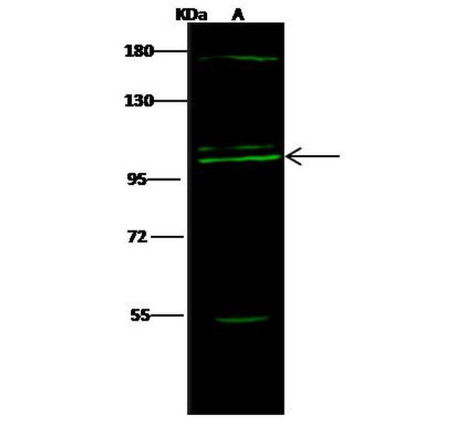 COPG Antibody in Western Blot (WB)