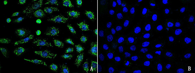 INHBB Antibody in Immunocytochemistry (ICC/IF)