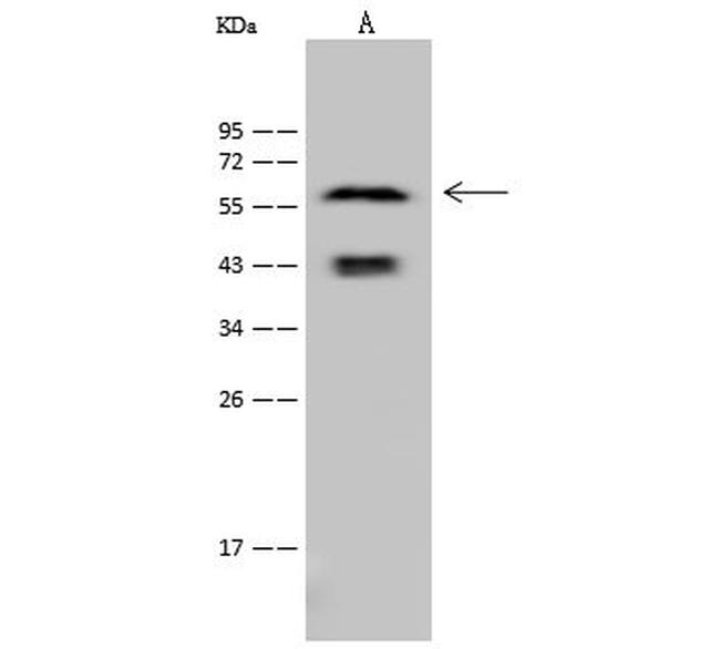 Cytokeratin 6A Antibody in Western Blot (WB)