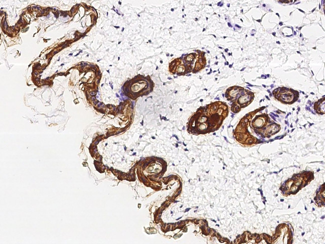 KRT79 Antibody in Immunohistochemistry (Paraffin) (IHC (P))