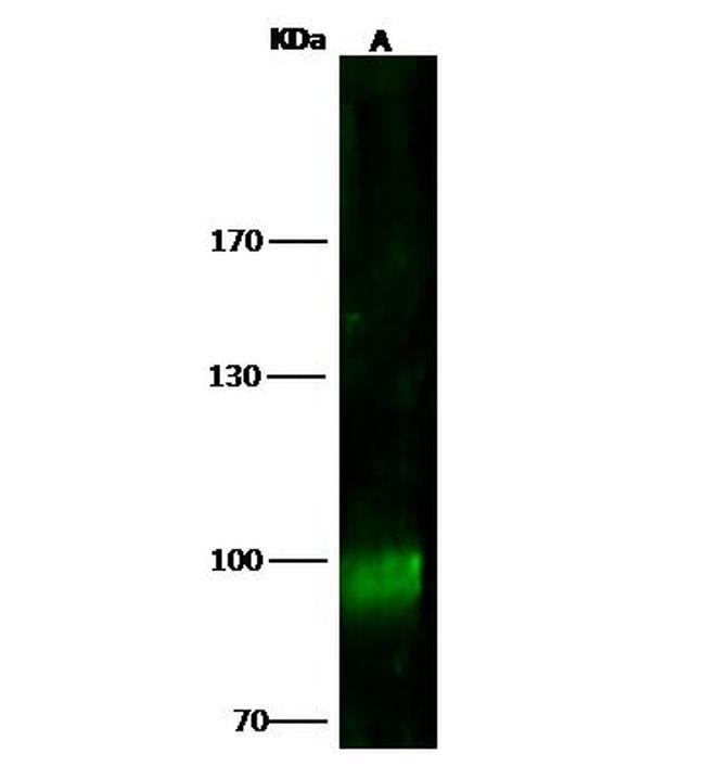 MSH5 Antibody in Western Blot (WB)