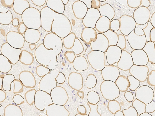 Perilipin 1 Antibody in Immunohistochemistry (Paraffin) (IHC (P))