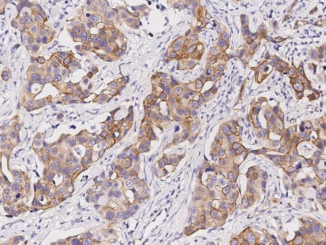 SENP8 Antibody in Immunohistochemistry (Paraffin) (IHC (P))