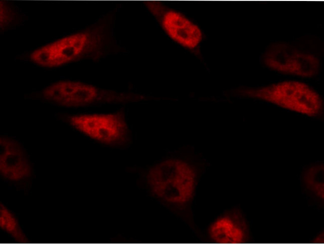 BRG1 Antibody in Immunocytochemistry (ICC/IF)