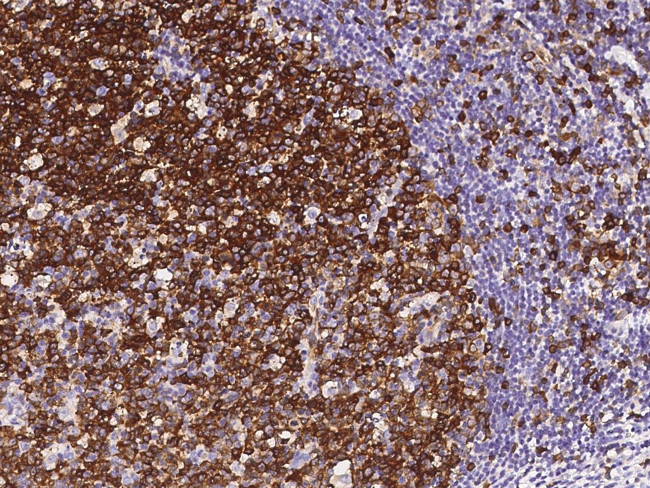 Stathmin 1 Antibody in Immunohistochemistry (Paraffin) (IHC (P))