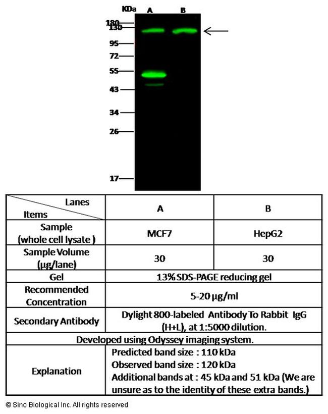 TSC22D1 Antibody in Western Blot (WB)