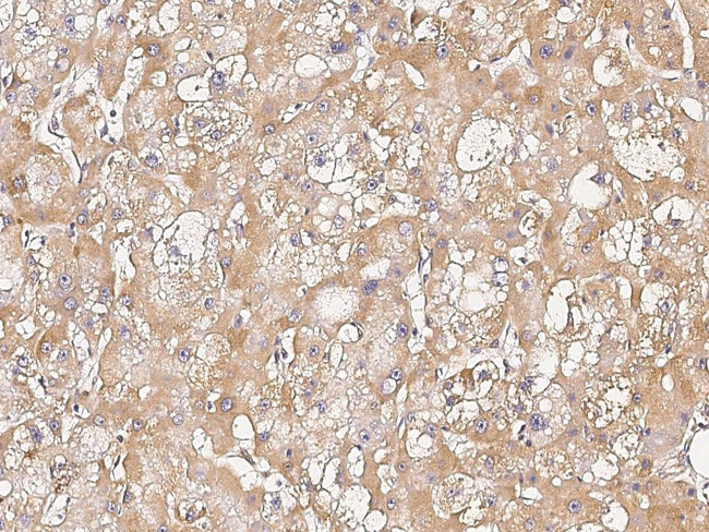 UBE4B Antibody in Immunohistochemistry (Paraffin) (IHC (P))