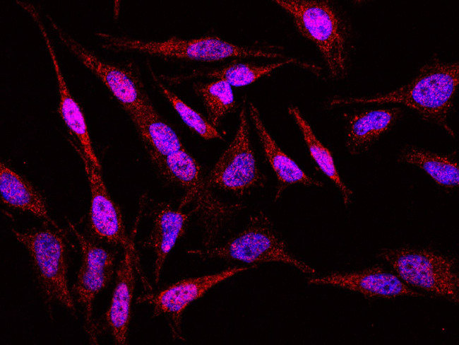 CaMKIV Antibody in Immunocytochemistry (ICC/IF)