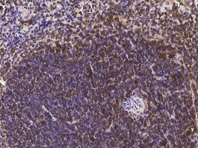 CD45 Antibody in Immunohistochemistry (Paraffin) (IHC (P))