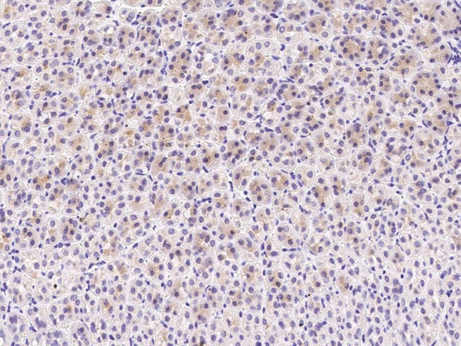 C1QB Antibody in Immunohistochemistry (Paraffin) (IHC (P))