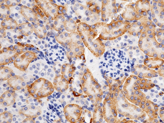 Carbonic Anhydrase XII Antibody in Immunohistochemistry (Paraffin) (IHC (P))