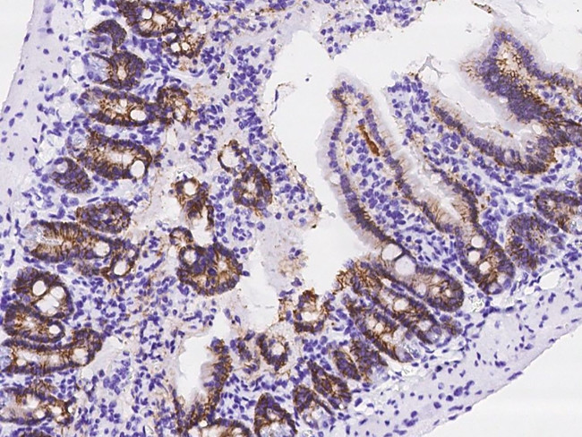Carbonic Anhydrase IX Antibody in Immunohistochemistry (Paraffin) (IHC (P))
