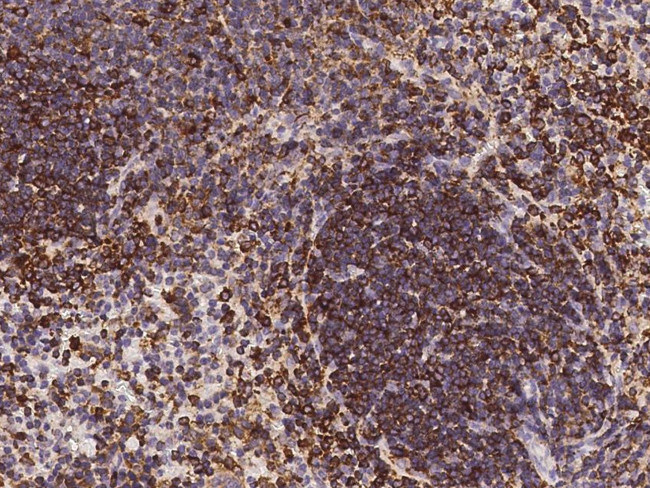 CD180 Antibody in Immunohistochemistry (Paraffin) (IHC (P))